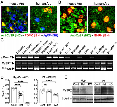 Extracellular Ca2+-Sensing Receptor (CaSR) Regulates Hypothalamic Function to Control Energy and Skeletal Metabolism in Mice