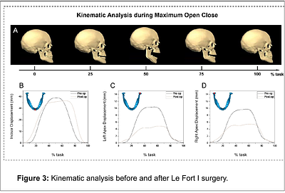 A Chairside Multimodal Platform for Temporomandibular Joint Biomechanical Assessment: Technical Evaluation and Illustrative Application