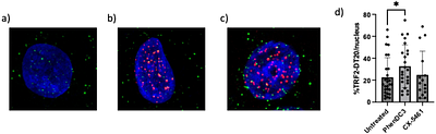 Antibody targeting the anti-parallel topology of human telomeric G-quadruplex DNA