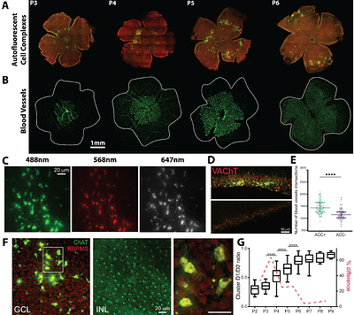 Developmental Synchrony of Retinal Waves, Apoptosis, and Angiogenesis in Postnatal Retina
