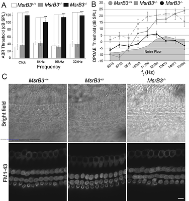 Methionine sulfoxide reductase B3 antioxidant activity is indispensable for mouse inner ear cuticular plate structure and hair bundle integrity