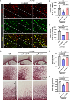 Expression of amyloid-β antibody via AAV of CNS tropism alleviates Alzheimer's disease in mice