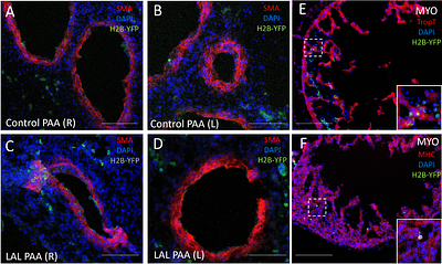 Altered Cardiac Neural Crest Migration Patterning in a Left Atrial Ligation Model of Hypoplastic Left Heart Syndrome
