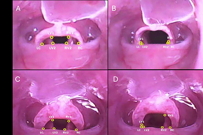 Deep Learning-Assisted Evaluation of Laryngeal Mobility in a Rat Model