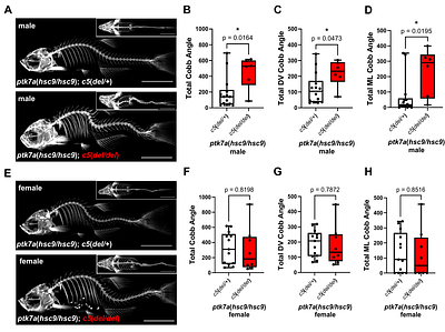 Pre-clinical models of idiopathic scoliosis implicate sex-specific roles for complement activity in modulating spinal curve severity