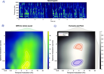The shape of attention: How cognitive goals sculpt cortical representation of speech.