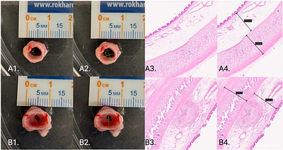 Airway Diameter-Matched Injury Improves Severity and Reproducibility of Experimental Rabbit Tracheal Stenosis
