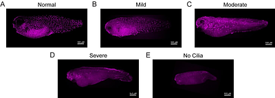 Epilepsy-associated potassium channel KCNT1 is required for multiciliated cell development in Xenopus