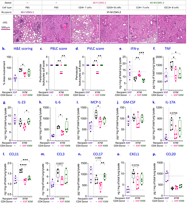 Intrinsic T-cell programming and immune spatial organization govern sex-biased tuberculosis immunity