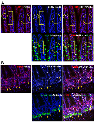 IRE1α and IRE1β Protect Intestinal Epithelium and Suppress Colorectal Tumorigenesis through Distinct Mechanisms