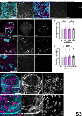 Toll receptors mediate tissue intrinsic surveillance against aberrant cells by detecting cell fate aberrations
