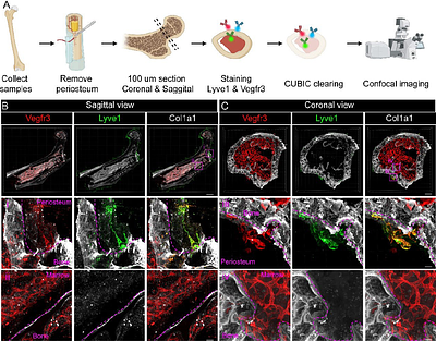 Periosteal and periarticular compartments house lymphatic vessels in bone