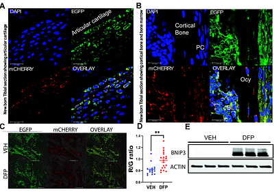 Impaired mitochondrial stress signaling mediates bone loss in male mice in the absence of BNIP3.