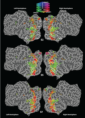 Meta-learning In-Context Enables Training-Free Cross Subject Brain Decoding