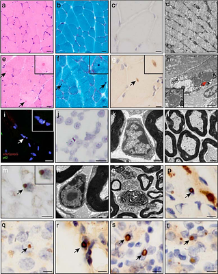 A novel uN2CpolyG Transgenic Mouse Model Recapitulates Multisystemic polyG Proteinopathy Pathology of Neuronal Intranuclear Inclusion Disease
