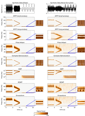 NeuroFreq: a MATLAB Toolbox for Time-Frequency Analysis of M/EEG Data