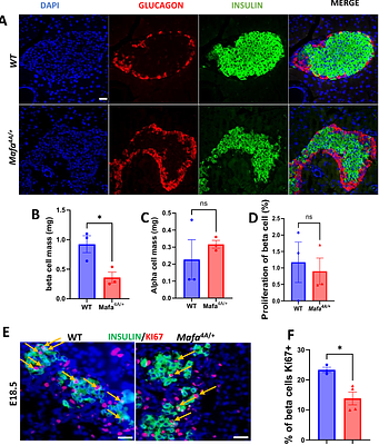 MAFA Phosphorylation Controls Beta-Cell Identity and Sex-Specific Pancreatic Disease Outcomes