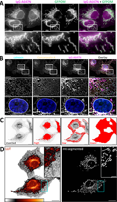 From background to foreground: secondary antibodies coupled to lipophilic ATTO dyes enable high-density membrane labeling in super-resolution and expansion microscopy