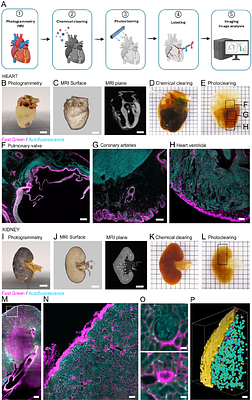 Whole human organ clearing and multimodal mapping