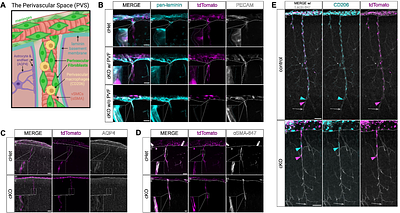 PDGFRα is required for postnatal cerebral perivascular fibroblast development