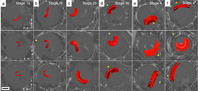 Deciphering Coccolith Formation: Advanced Microscopy Insights from the Biomineralisation of Gephyrocapsa huxleyi