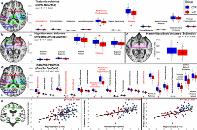 Diencephalic and white matter knock-on effects in hippocampal amnesia - why they matter