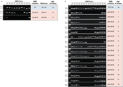 Increased utrophin expression in healthy and DMD patient derived myoblasts in response to ERK1/2 and EZH2 inhibitor treatment