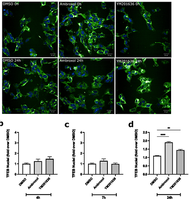 Reduction of a-synuclein aggregates by PIKfyve inhibition via TFEB-mediated lysosomal biogenesis in a Parkinson disease model