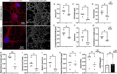 Mitochondrial dysfunction in Machado Joseph disease: insights from a multi-model system