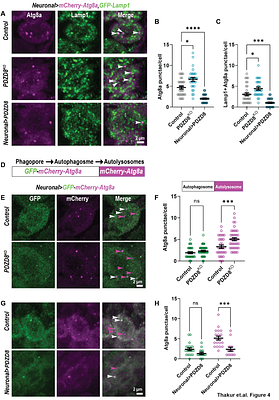 PDZD8 promotes autophagy at ER-Lysosome contact sites to regulate synaptogenesis