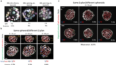 Digitalized organoids: integrated pipeline for 3D high-speed analysis of organoid structures using multilevel segmentation and cellular topology