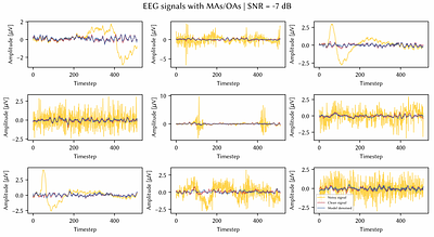 A multi-artifact EEG denoising by frequency-based deep learning