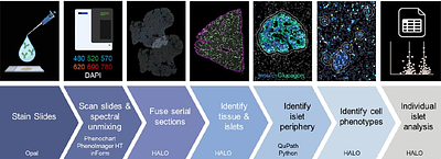 Characterisation of native human pancreatic mesenchymal stromal cells in type 1 diabetes