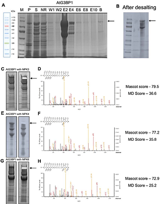 G3BP1 Phosphorylation Regulates Plant Immunity in Arabidopsis
