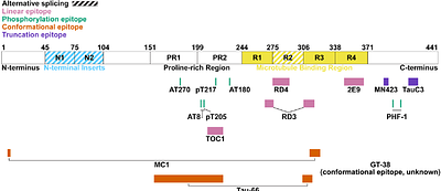 The Neurofibrillary Tangle Maturity Scale: A Novel Framework for Tangle Pathology Evaluation in Alzheimer's Disease