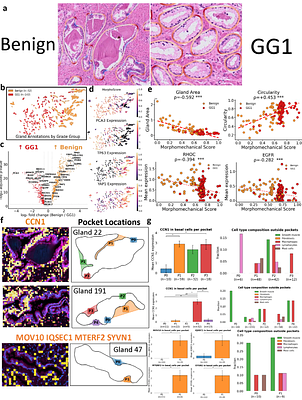 Morphomechanically-Informed Spatial Curvature Sequencing in Prostate Cancer