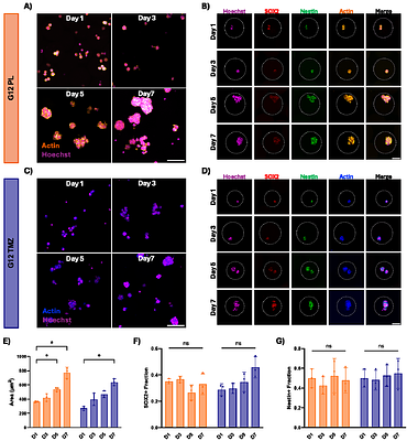 Expanding Microgel Parameters to Model the Tumor Microenvironment and Examine Temozolomide Resistance in Glioblastoma