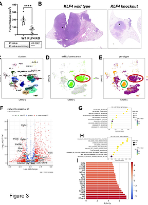 Klf4-dependent pivotal role of smooth muscle-derived Gli1+ lineage progenitor cells in lung cancer progression