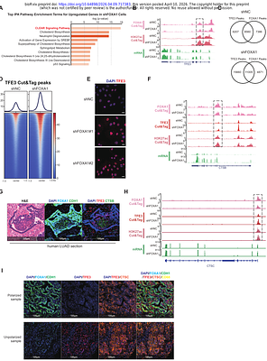 FOXA1 preserves cell polarity and restrains lysosome biogenesis in non-small cell lung adenocarcinoma