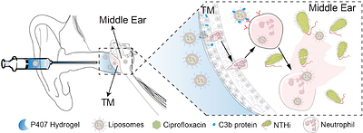 Harnessing Neutrophils to Deliver Antibiotics Non-Invasively across the Tympanic Membrane for Otitis Media Treatment
