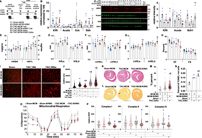 Restoring Klf9 Expression with Pressure Overload Leads to Metabolic Maladaptation and Early Onset of Heart Failure