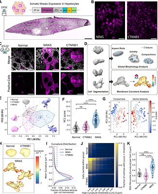 Deciphering the Multiscale Morphology of Somatic Oncogenic Alterations in Hepatocellular Carcinoma