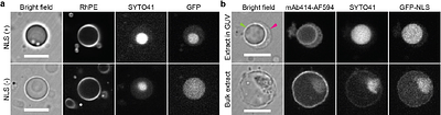 Nuclear assembly in giant unilamellar vesicles encapsulating Xenopus egg extract