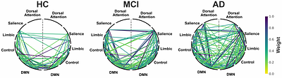 Brain Network Analysis in Alzheimer's Disease and Mild Cognitive Impairment using High-Density Diffuse Optical Tomography