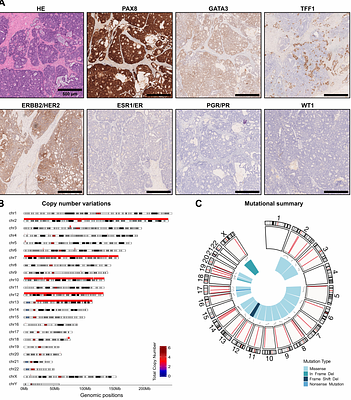 Organoids serve as viable in vitro model for functional precision medicine for mesonephric-like adenocarcinoma of the ovary