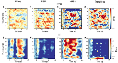 From Variability to Synchrony: Non-linear Development of Auditory Neural Responses During the First Year of Life