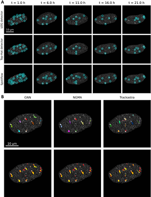 LiFT: Live foci tracking for quantitative analysis of DNA damage dynamics