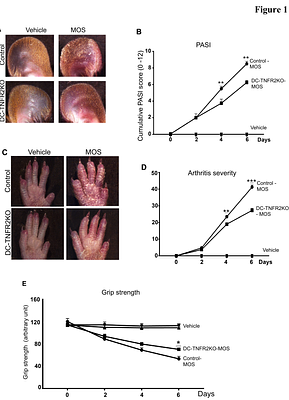 Targeting dendritic cell-specific TNFR2 improves skin and joint inflammation by inhibiting IL-12/ IFN-γ pathways in a mouse model of psoriatic arthritis.