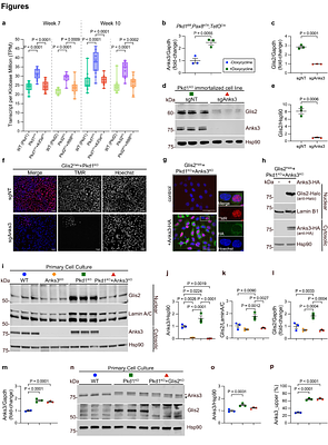 Anks3 mediates cilia dependent polycystin signaling and is essential for adult kidney homeostasis