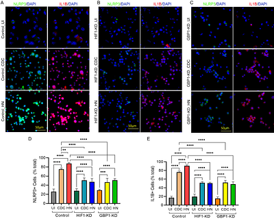 Inflammasome activation differences underpin different Mycobacterium tuberculosis infection outcomes